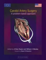 Carotid Artery Surgery - 