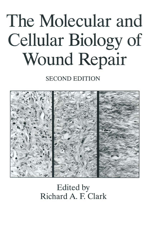 The Molecular and Cellular Biology of Wound Repair - 