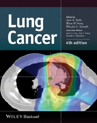 Lung Cancer - 