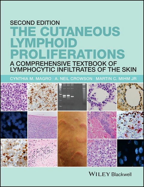 The Cutaneous Lymphoid Proliferations - Cynthia M. Magro, A. Neil Crowson, Martin C. Mihm