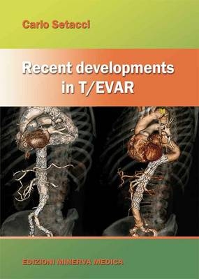 Recent Developments in T/EVAR - 