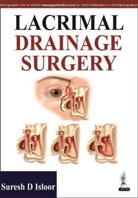 Lacrimal Drainage Surgery - Suresh D Isloor