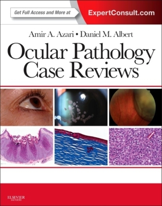 Ocular Pathology Case Reviews - Amir A. Azari, Daniel M. Albert