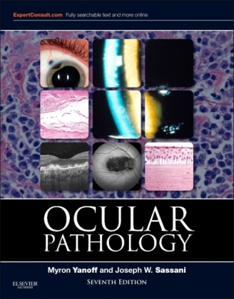 Ocular Pathology - Myron Yanoff, Joseph W. Sassani