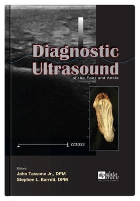 Diagnostic Ultrasound of the Foot and Ankle - 