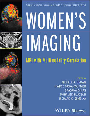 Women′s Imaging – MRI with Multimodality Correlation - MA Brown