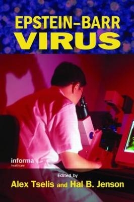 Epstein-Barr Virus - 