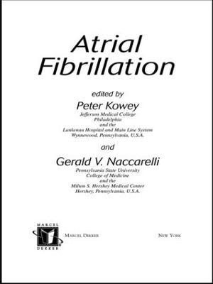 Atrial Fibrillation - 