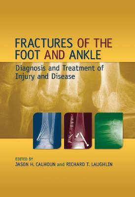 Fractures of the Foot and Ankle - 