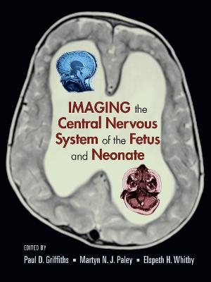 Imaging the Central Nervous System of the Fetus and Neonate - 