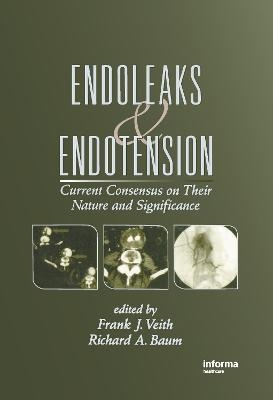 Endoleaks and Endotension - 