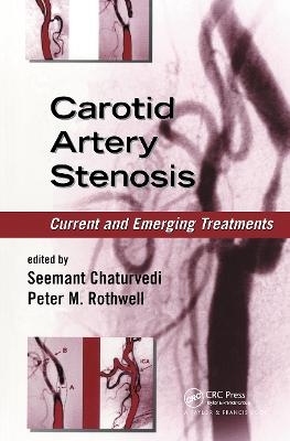 Carotid Artery Stenosis - 