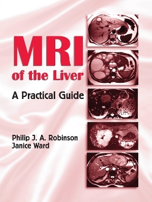 MRI of the Liver - Philip J. A. Robinson, Janice Ward