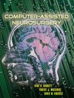 Computer-Assisted Neurosurgery - 