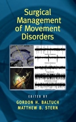 Surgical Management of Movement Disorders - 