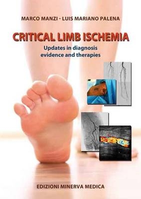 Critical limb ischemia - 