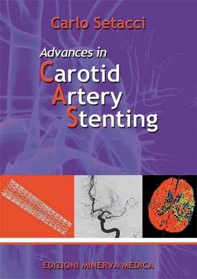 Advances in Carotid Artery Stenting - 