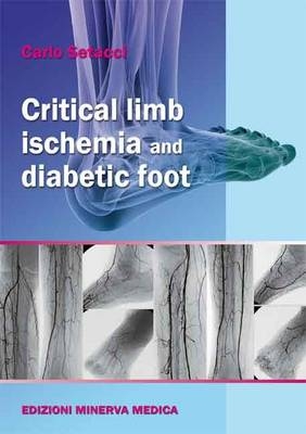 Critical Limb Ischemia and Diabetic Foot - 