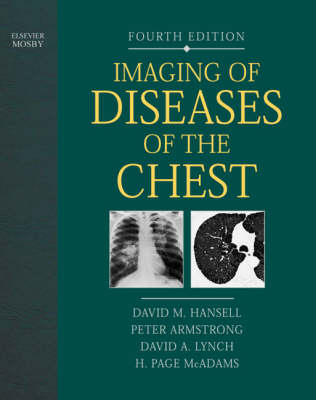 Imaging of Diseases of the Chest - David M. Hansell, Peter Armstrong, David A. Lynch, H. Page McAdams