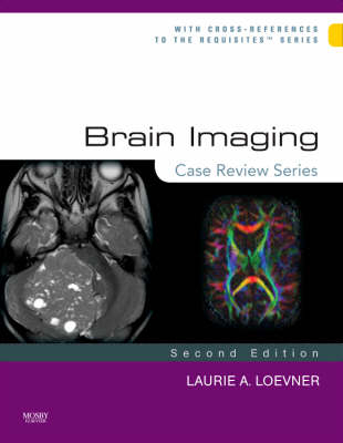 Brain Imaging: Case Review Series - Laurie A. Loevner