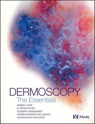 Dermoscopy - Robert H. Johr, H. Peter Soyer, Giuseppe Argenziano, Rainer Hofman-Wellenhof, Massimiliano Scalvenzi