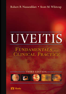 Uveitis - Robert B. Nussenblatt, Scott M. Whitcup