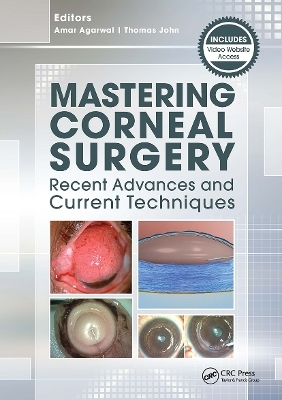 Mastering Corneal Surgery - Amar Agarwal, Thomas John