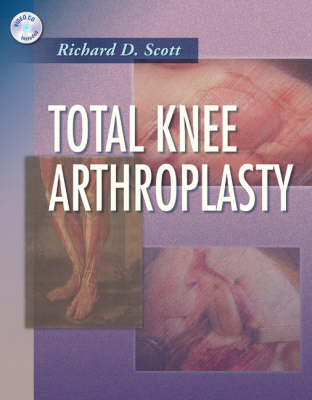 Total Knee Arthroplasty - Richard D. Scott