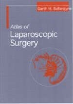 Atlas of Laparoscopic Surgery - Garth H. Ballantyne