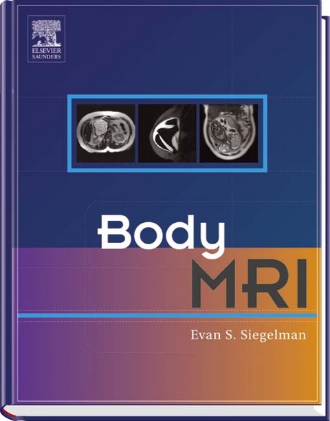 Body MRI - Evan S. Siegelman