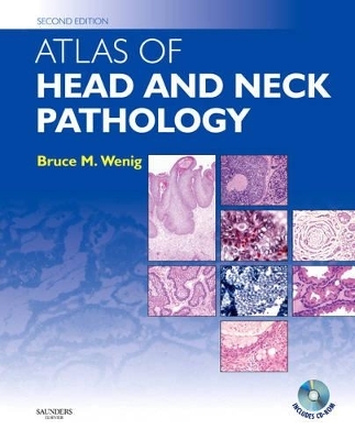 Atlas of Head and Neck Pathology - Bruce M. Wenig