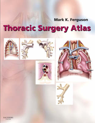 Thoracic Surgery Atlas - Mark K. Ferguson