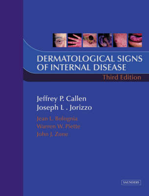 Dermatological Signs of Internal Disease - Jeffrey P. Callen, Joseph L. Jorizzo, Jean L. Bolognia, Warren Piette, John J. Zone