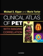 Clinical Atlas of PET with Imaging Correlation - Michael S. Kipper, Marie Tartar