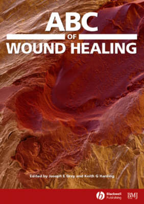 ABC of Wound Healing - 