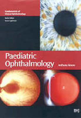 Paediatric Ophthalmology - 