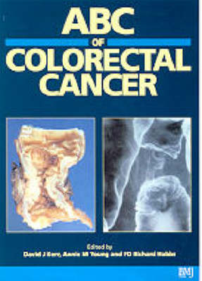 ABC of Colorectal Cancer - 