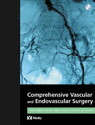 Comprehensive Vascular and Endovascular Surgery - John W. Hallett, Joseph L. Mills, Jonathan Earnshaw, Jim A. Reekers