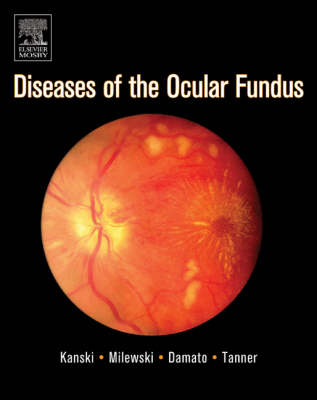 Diseases of the Ocular Fundus - Jack J. Kanski, Stanislaw A. Milewski, Bertil E. Damato, Vaughan Tanner