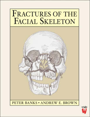 Fractures of the Facial Skeleton - Peter Banks, Andrew Brown