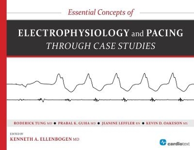 Essential Concepts of Electrophysiology and Pacing Through Case Studies - Kenneth A Ellenbogen, Roderick Tung, Prabal Guha