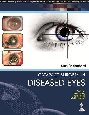 Cataract Surgery in Diseased Eyes - Arup Chakrabarti