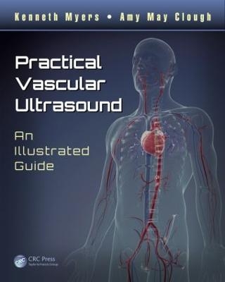 Practical Vascular Ultrasound - Kenneth Myers, Amy May Clough