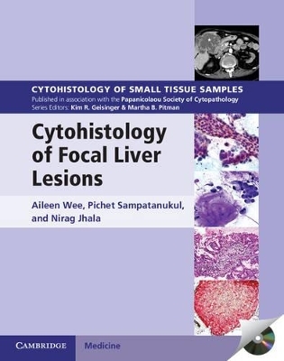 Cytohistology of Focal Liver Lesions - Aileen Wee, Pichet Sampatanukul, Nirag Jhala