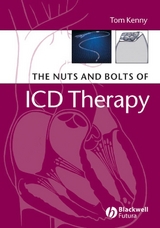 The Nuts and Bolts of ICD Therapy - Tom Kenny