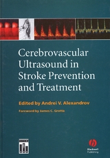 Cerebrovascular Ultrasound in Stroke Prevention and Treatment - 