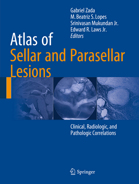 Atlas of Sellar and Parasellar Lesions - 