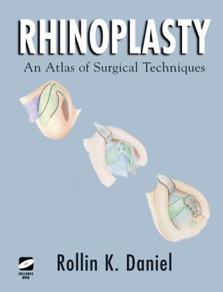 Rhinoplasty -  Rollin K. Daniel