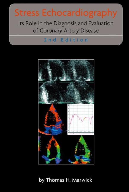 Stress Echocardiography -  Thomas H. Marwick