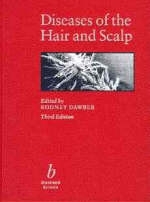 Diseases of the Hair and Scalp - 